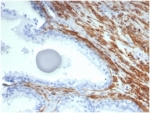 Recombinant SMMHC Antibody Prostate IHC. Immunohistochemical staining of FFPE human prostate tissue demonstrates Smooth Muscle Myosin Heavy Chain expression using recombinant SMMHC antibody clone MYH11/7087R. SMMHC, encoded by the MYH11 gene, is a highly specific marker of differentiated smooth muscle and myoepithelial cells. Strong cytoplasmic staining highlights the smooth muscle stroma surrounding prostatic glands, while the glandular epithelium remains largely negative. This characteristic distribution reflects the abundant contractile smooth muscle component of the prostate and underscores the utility of SMMHC as a marker of smooth muscle differentiation. Heat induced epitope retrieval was performed by boiling tissue sections in pH 9 10 mM Tris with 1 mM EDTA for 20 minutes followed by cooling prior to staining. These results support the utility of SMMHC Antibody for studies of prostate histology, smooth muscle biology, and diagnostic pathology.
