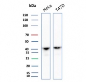 Western blot testing of human HeLa and T-47D cell lysate with Actin alpha 1 antibody. Predicted molecular weight ~42 kDa.