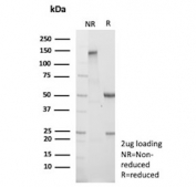 SDS-PAGE analysis of purified, BSA-free Actin alpha 1 antibody (clone ACTA1/360) as confirmation of integrity and purity.