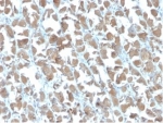 MICA Antibody Stomach Tissue IHC. Immunohistochemistry staining of FFPE human stomach with MICA antibody (clone MICA/4442). HIER: boil tissue sections in pH 9 10mM Tris with 1mM EDTA for 20 min and allow to cool before testing.