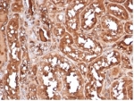 MICA Antibody Human Kidney IHC. Immunohistochemistry staining of FFPE human kidney tissue with MICA antibody (clone MICA/4443). HIER: boil tissue sections in pH 9 10mM Tris with 1mM EDTA for 20 min and allow to cool before testing.