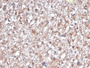 PKC Iota Antibody / PRKCI Antibody Human Brain IHC. Immunohistochemical staining of FFPE human brain tissue using PKC Iota Antibody / PRKCI Antibody, clone PRKCI/4912. PRKCI expression is observed as predominantly cytoplasmic staining throughout neural cells, consistent with its established roles in neuronal polarity, intracellular signaling, and maintenance of cellular architecture. Heat-induced epitope retrieval was performed using pH 9 Tris-EDTA buffer for 20 minutes prior to immunostaining.