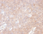 IL6 Antibody Human Tonsil IHC. Immunohistochemical staining of FFPE human tonsil tissue using IL6 Antibody / Interleukin-6 Antibody (clone IL6/4641) demonstrates widespread cytoplasmic HRP-DAB brown staining within lymphoid-associated cellular populations. The observed staining pattern is consistent with expression of IL6, a key pro-inflammatory cytokine involved in immune cell communication, lymphocyte activation, and regulation of inflammatory responses. Tonsil tissue represents an immunologically active microenvironment, making it a useful model for evaluating cytokine expression and immune signaling pathways. These results support the application of this antibody in studies of inflammation, immunology, cytokine biology, and immune-mediated disease mechanisms. HIER: boil tissue sections in pH 9 10mM Tris with 1mM EDTA for 20 min and allow to cool before testing.