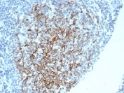 CD35 Antibody Spleen IHC. Immunohistochemistry of CD35 / CR1 in FFPE human spleen tissue using mouse monoclonal CD35 antibody, clone CR1/6378. HRP-DAB brown staining highlights a follicular dendritic cell network within splenic white pulp, showing a reticular mesh-like pattern consistent with complement receptor localization in germinal center-associated stromal cells, while surrounding lymphoid cells show minimal staining and nuclei are counterstained blue. Heat induced epitope retrieval was performed by boiling tissue sections in pH 9 10 mM Tris with 1 mM EDTA for 20 min followed by cooling prior to staining.