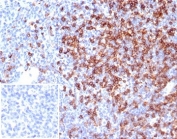 CD4 Antibody for IHC. Analysis of CD4 antibody staining in FFPE human tonsil tissue shows strong membranous labeling of CD4-positive T helper lymphocytes within interfollicular regions and surrounding lymphoid follicles, highlighting sites of T cell interaction within lymphoid tissue. This Immunological Synapse Formation Antibody (clone CD4/7142) demonstrates selective detection of CD4-expressing lymphocytes involved in cell-cell contact and immune synapse organization. Inset: PBS was used in place of the primary antibody as a negative control to assess secondary antibody binding. Heat-induced epitope retrieval was performed by boiling tissue sections in pH 9 10 mM Tris with 1 mM EDTA for 20 minutes followed by cooling before testing.
