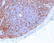CD4 Antibody for IHC. Analysis of CD4 antibody staining in FFPE human lymph node tissue shows strong membranous labeling of CD4-positive T helper lymphocytes predominantly within paracortical regions, with relative sparing of B cell follicles, highlighting adaptive immune cell distribution within lymphoid tissue. This Adaptive Immunity Marker Antibody (clone CD4/7144) demonstrates selective detection of T helper cell populations involved in coordinating adaptive immune responses. Heat-induced epitope retrieval was performed by boiling tissue sections in pH 9 10 mM Tris with 1 mM EDTA for 20 minutes followed by cooling before testing.
