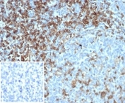 CD4 Antibody for IHC. Analysis of CD4 antibody staining in FFPE human tonsil tissue shows strong membranous labeling of CD4-positive T helper lymphocytes within interfollicular regions and surrounding lymphoid follicles, highlighting adaptive immune cell distribution within lymphoid tissue. This Adaptive Immunity Marker Antibody (clone CD4/7144) demonstrates selective detection of T helper cell populations involved in coordinating adaptive immune responses. Inset: PBS was used in place of the primary antibody as a negative control to assess secondary antibody binding. Heat-induced epitope retrieval was performed by boiling tissue sections in pH 9 10 mM Tris with 1 mM EDTA for 20 minutes followed by cooling before testing.