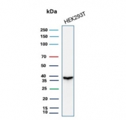 Recombinant Aldose reductase 1B1 Antibody WB. Western blot testing of human 293T cell lysate with recombinant Aldose reductase 1B1 antibody (clone rAKR1B1/7296). Predicted molecular weight ~36 kDa.