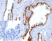 Prostein Antibody for IHC. Immunohistochemistry analysis of Prostein / SLC45A3 antibody staining in FFPE human prostate tissue using clone SLC45A3/7176R. Strong cytoplasmic and perinuclear staining is observed in prostate glandular epithelial cells lining luminal structures, consistent with Golgi-associated localization of Prostein, while surrounding stromal cells remain negative. The negative control inset using PBS in place of primary antibody shows no staining, confirming specificity of the signal. This staining pattern supports selective detection of SLC45A3 in prostate epithelial cells in immunohistochemistry applications. Heat-induced epitope retrieval was performed in pH 9 Tris-EDTA buffer for 20 minutes followed by cooling prior to antibody incubation.