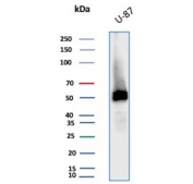 Vimentin Antibody / Cellular Plasticity Marker Antibody WB. Western blot analysis of human U-87 MG cell lysate using Vimentin antibody detects a prominent band at approximately 55 kDa, consistent with the predicted molecular weight of Vimentin (VIM). The rabbit monoclonal clone VIM/6576R shows a clear band, supporting detection of intermediate filament components associated with adaptable cellular states. The presence of Vimentin in U-87 MG cells aligns with its role in cytoskeletal organization linked to phenotypic flexibility and cellular plasticity.