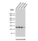 Galectin 3 Antibody by WB in human tissues and cells. Western blot analysis of human heart, lung, and skin tissue lysates, together with PANC-28 cell lysate, using Galectin 3 Antibody LGALS3/13233R. The expected molecular weight of galectin-3 is approximately 26 kDa.