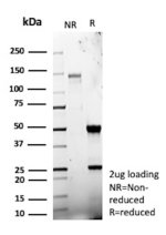 Galectin 3 Recombinant Rabbit Monoclonal Antibody Purity by SDS-PAGE. SDS-PAGE analysis of purified Galectin 3 Antibody LGALS3/13233R under non-reducing (NR) and reducing (R) conditions, with 2 ug of antibody loaded per lane. The gel shows intact antibody under non-reducing conditions and heavy and light chains under reducing conditions.