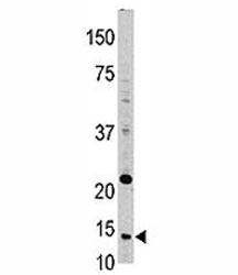 Western blot analysis of Thioredoxin in HL-60 lysate