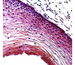 Puma antibody immunohistochemistry analysis in formalin fixed and paraffin embedded human cervix tissue.