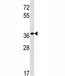 PGA5 antibody western blot analysis in NCI-H292 lysate.