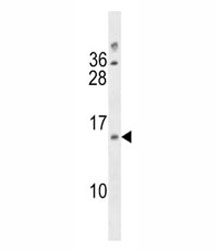 LIMS3L / LIMS3 antibody western blot analysis in 293 lysate.