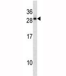 HOXD12 antibody western blot analysis in A549 lysate. Predicted molecular weight: ~29kDa.