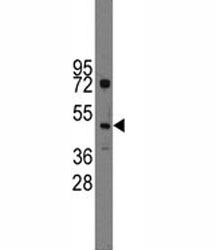 Western blot analysis of Ihh antibody and HL-60 lysate