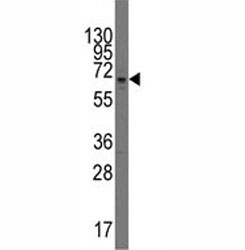 Western blot analysis of PARP3 antibody and mouse spleen tissue lysate.