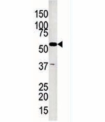 Glycerol kinase 2 antibody used in western blot to detect GK2 in Jurkat lysate