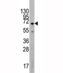 Western blot analysis of MAPK4 antibody and Jurkat lysate.