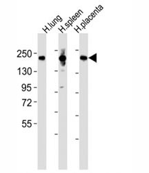 Western blot testing of MRC1L1 antibody at 1:2000 dilution and human samples: Lane 1: lung lysate; 2: spleen lysate; 3: placenta lysate; Predicted band size : 166 kDa.