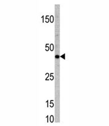 Western blot analysis of TCF7 antibody and mouse heart tissue lysate.