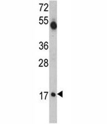 Western blot analysis of UBE2V1 antibody and mouse cerebellum tissue lysate.