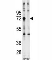 Western blot analysis of Ubiquilin-1 antibody pre-incubated with and without blocking peptide in Jurkat lysate