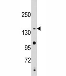 Western blot analysis of SMC2 antibody and Jurkat lysate.