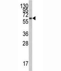 Western blot analysis of CYP26A1 antibody and Jurkat lysate