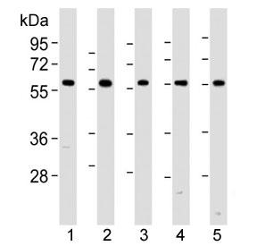 Western blot analysis of lysate from 1) human HeLa, 2) human A549, 3) mouse NIH3T3, 4) mouse C2C12, and 5) rat PC-12 lysate using PKM2 antibody at 1:1000. Predicted molecular weight ~58 KDa.