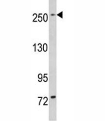 Western blot analysis of LRRK1 in mouse bladder tissue lysate