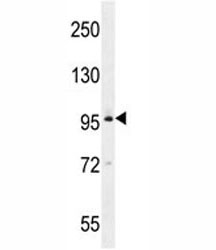BRDT western blot analysis in MDA-MB435 lysate. Predicted molecular weight ~108 kDa.