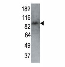 MARK1 antibody used in western blot to detect MARK1 in P7 mouse whole brain lysate (60 ug) at 1:250. Courtesy of Dr Shengli Zhao, Duke University Medical Center.