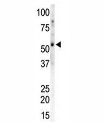 Western blot of CAMK2G and mouse heart tissue lysate