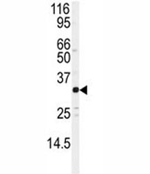 Western blot analysis of JUND antibody and Jurkat lysate. Predicted molecular weight: ~39/34kDa (JUND-L/JUND-S).