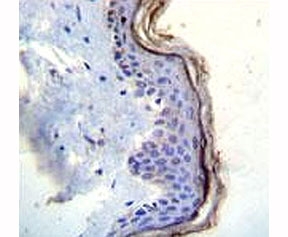 c-Kit antibody immunohistochemistry analysis in formalin fixed and paraffin embedded human skin tissue.