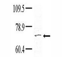 Western blot analysis of TNK1 antibody (1:100) in HeLa lysate; Courtesy of Dr. Richard Lu, Partners HealthCare System at Harvard University.