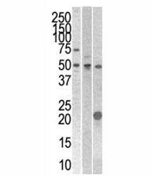 STYK1 antibody western blot analysis with 293, CEM, and mouse kidney cell line/tissue lysate