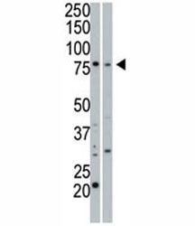 cGKI beta antibody used in western blot to detect cGKIbeta in 293 cell lysate (Lane 1) and mouse small intestine tissue lysate (2).