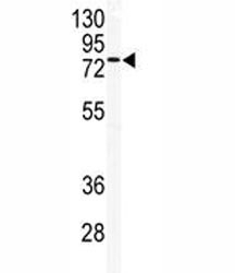 Western blot analysis of TLK2 antibody and mouse testis tissue lysate.
