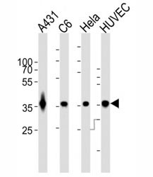 GAPDH antibody WB at 1:1000 dilution. Lane 1: A431 lysate; 2: rat C6; 3: HeLa; 4: HUVEC; Predicted band size : 36 kDa.