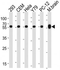 Western blot analysis of lysate from 293, CEM, HeLa, Y79, rat PC-12 cell line, mouse brain tissue lysate using TUBB / beta-Tubulin antibody at 1:1000 for each lane.