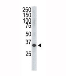 The VEGF4 antibody used in western blot to detect VEGF4 in HDMEC cell lysate. Expected molecular weight: 40-53 kDa (pro-form), ~21 kDa (mature/active form).