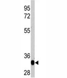 Western blot analysis of recombinant protein with LIN28A antibody