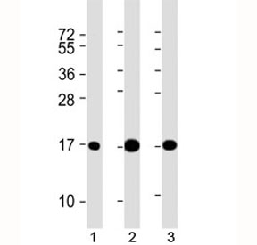 Western blot testing of 1) human brain, 2) mouse brain and 3) rat brain lysate with LC3 antibody at 1:2000. Predicted molecular weight ~14 kDa.