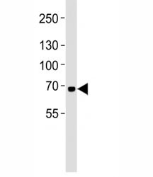Western blot analysis of lysate from K562 cell line using LTF antibody at 1:1000. Predicted molecular weight: ~78/73kDa (isoforms 1/2). (1)