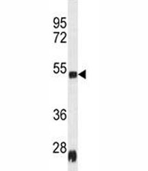 Western blot analysis of Serpinh1 antibody and rat heart tissue lysate; Ab used at 1:100.