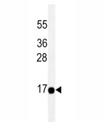 THEM2 antibody western blot analysis in HeLa lysate.